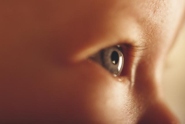 Prvi put u KCS: Presađivanje rožnjače u oku bebe